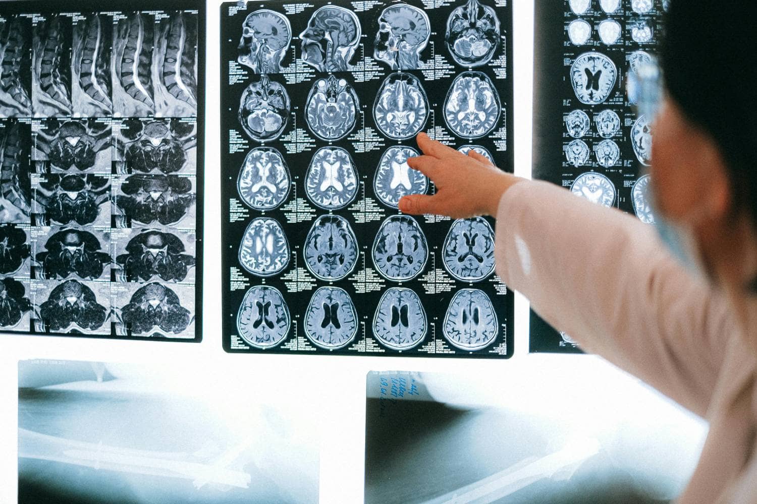 Better Answers for Living Patients